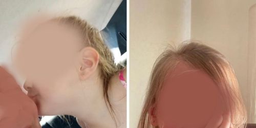 Shock a Vibo, bimba di quattro anni muore mentre era in vacanza in Russia