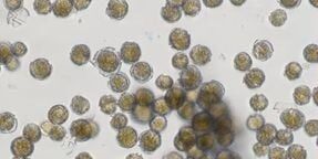 Alghe, studio universitario con dati Arpacal attesta una nuova presenza a Roccella