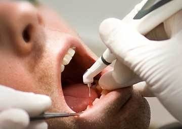 Faceva il dentista in un centro estetico, denunciato