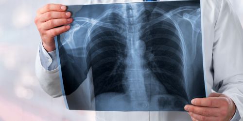 broncopneumologia-cs