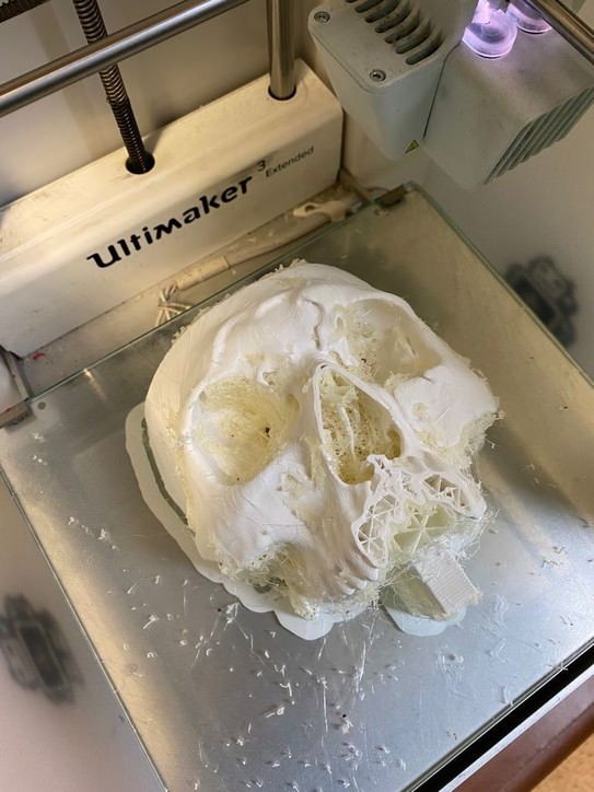 Un chirurgo calabrese nell'equipe che ha ricostruito in 3d il volto di un giovane