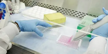 Difterite, la Sicilia corre ai ripari: istituita una task force