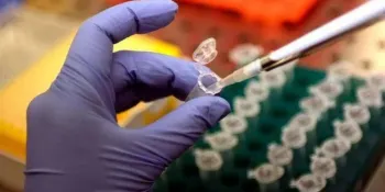 Hantavirus, sorveglianza su 4 passeggeri volo Klm. Coinvolta anche la Calabria