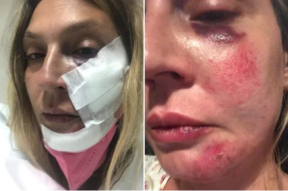 Ricercatrice pestata selvaggiamente a Tortora, identificati gli aggressori