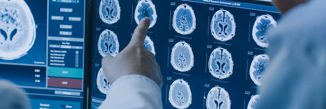 Nuova metodica per i tumori al sistema nervoso centrale