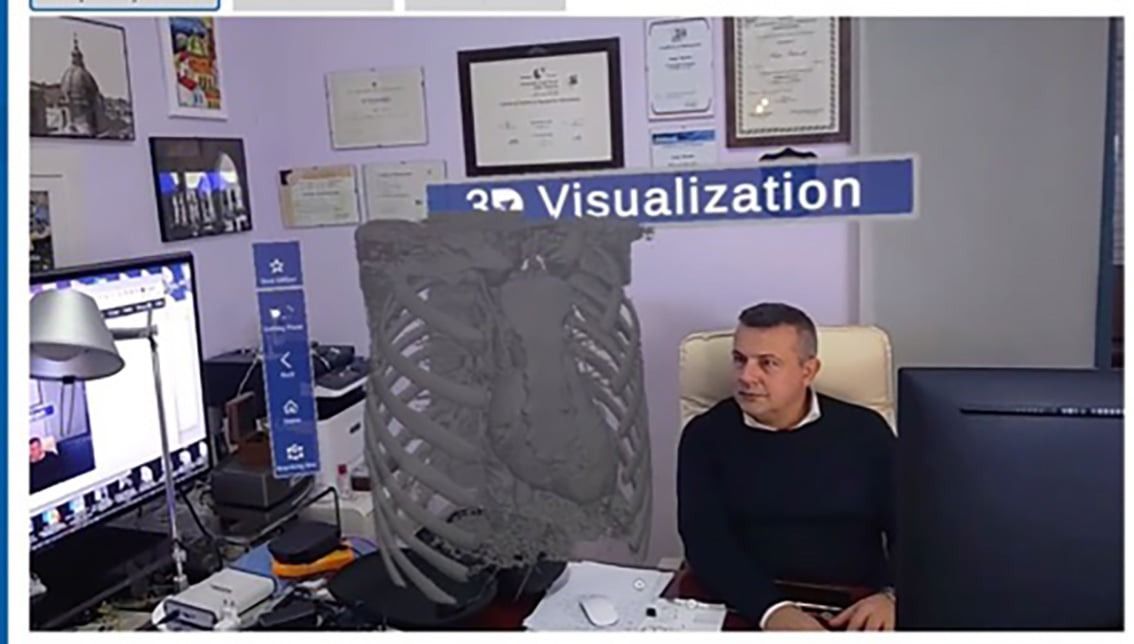 I malati di Sla potranno muoversi grazie ai pensieri. La speranza da una ricerca calabrese – VIDEO