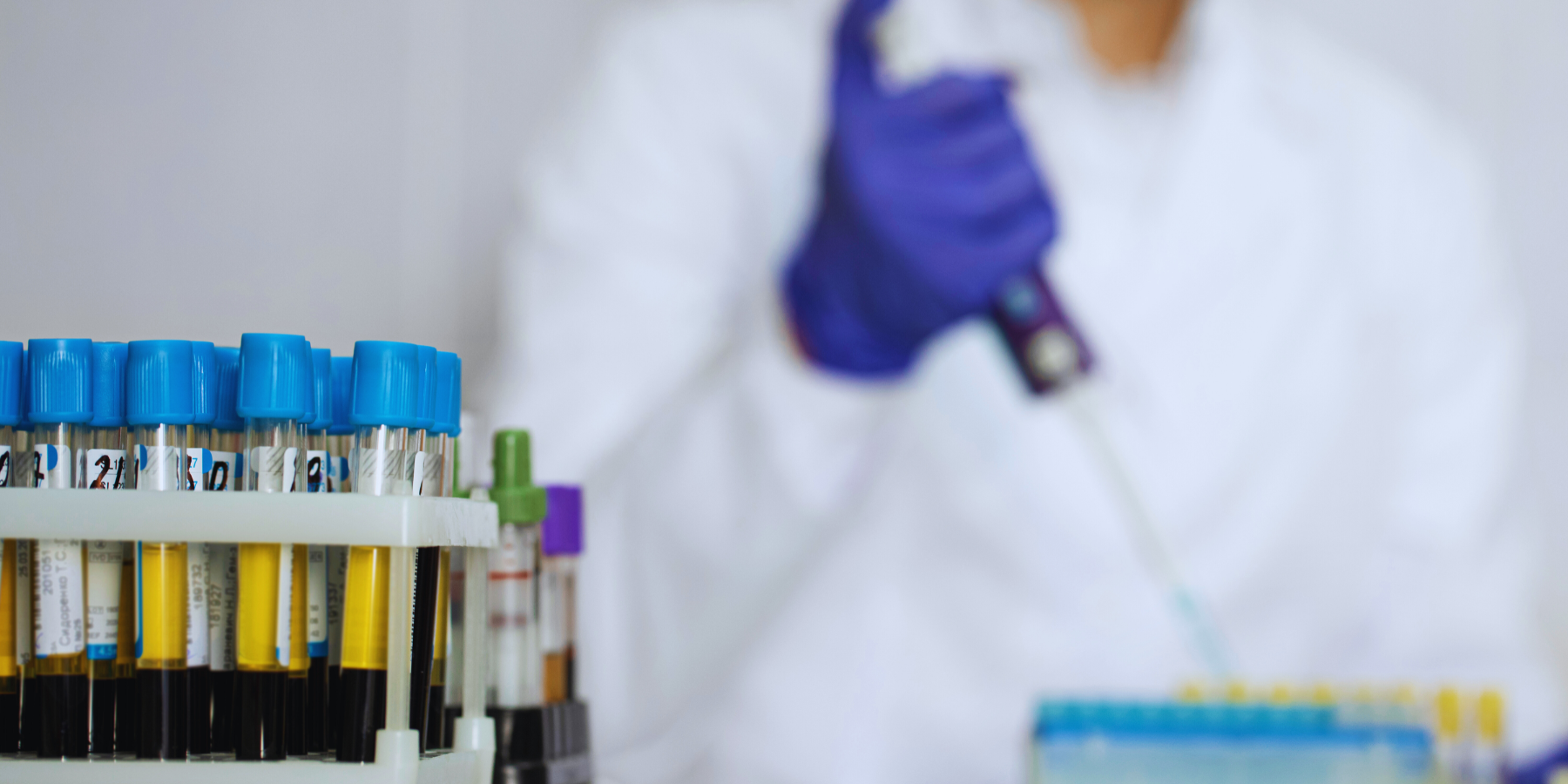 Rientrata a Cosenza con febbre e dolori dal Congo. Il ministero: «Nessun allarme»