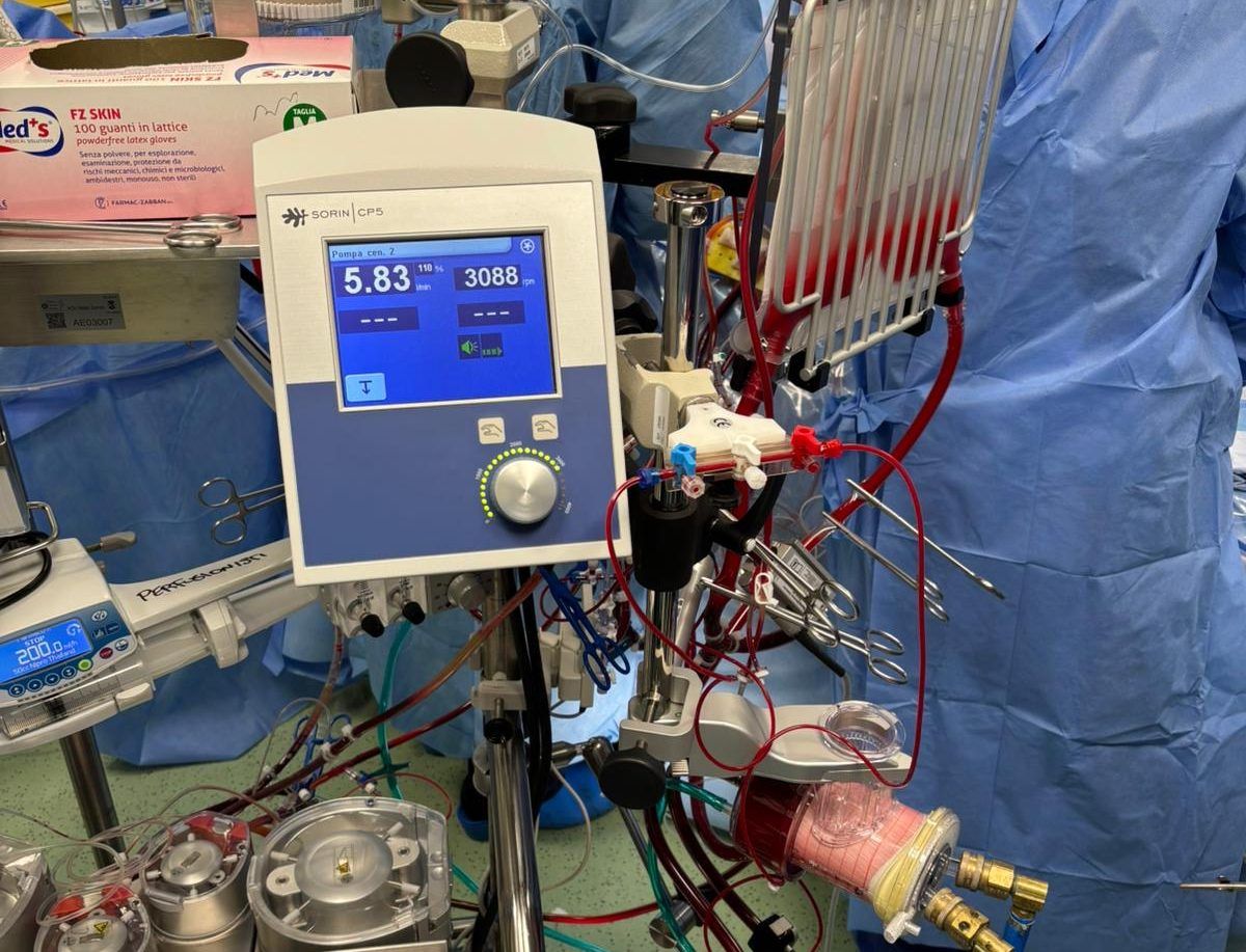 Tecnologia d’avanguardia alla Dulbecco: avviato il programma “mini-circolazione extracorporea”