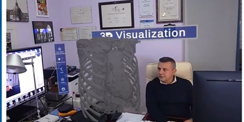 arrigo_palumbo_ricerca_malati_sla