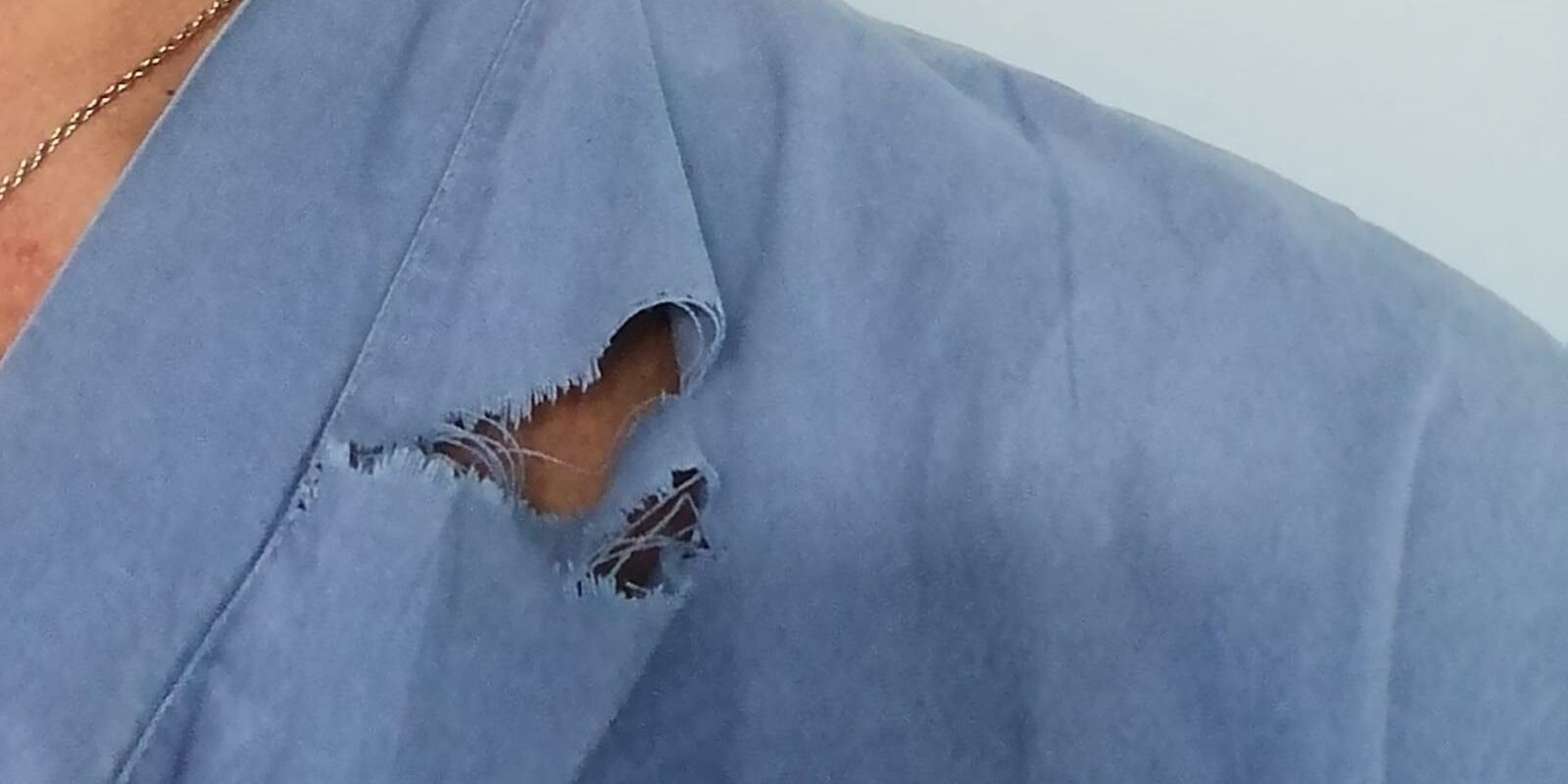 Corigliano Rossano, ennesima aggressione al personale sanitario del “Giannettasio”