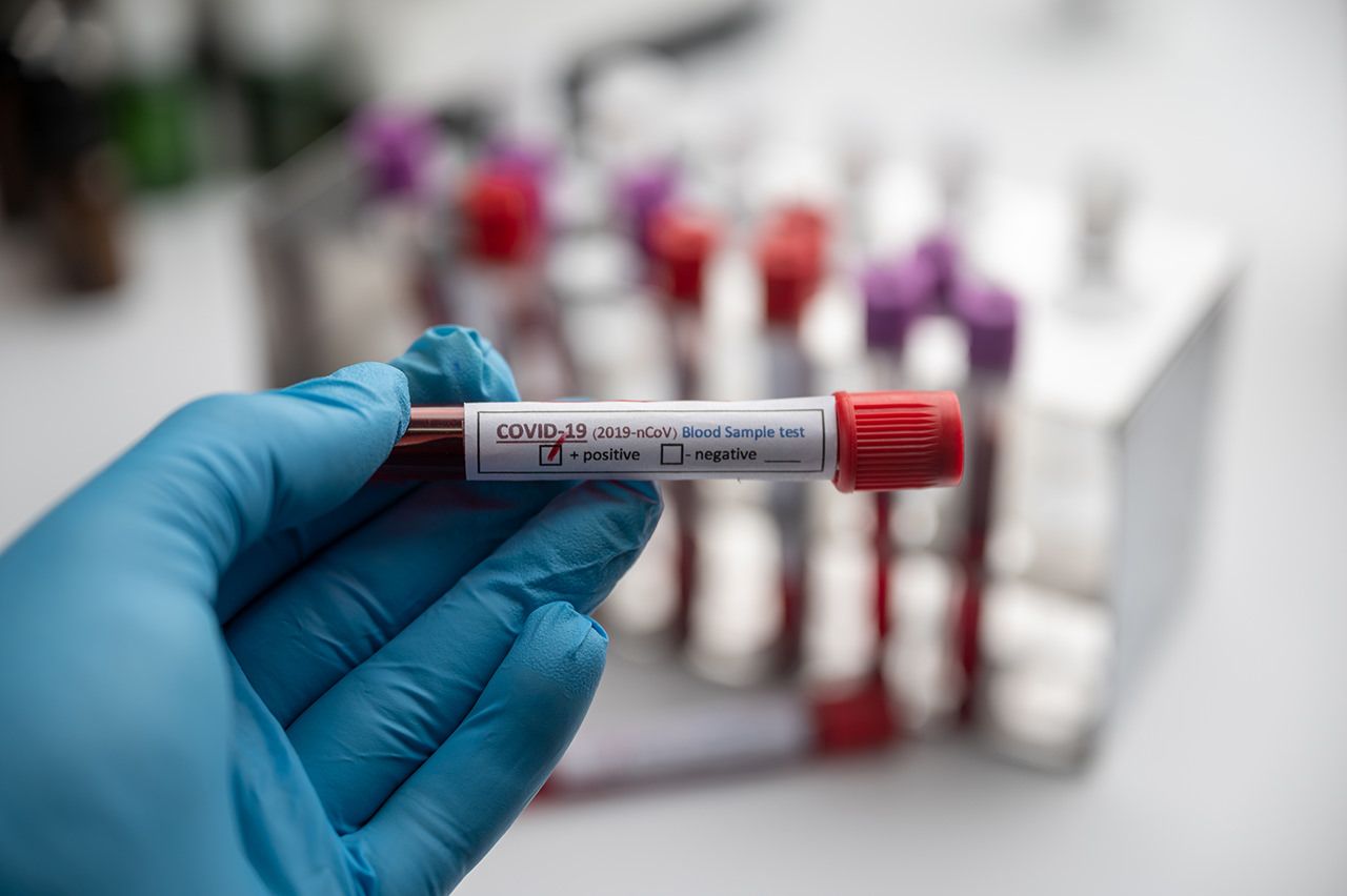 Emergenza Covid, Frascineto resta zona rossa fino al 24 gennaio