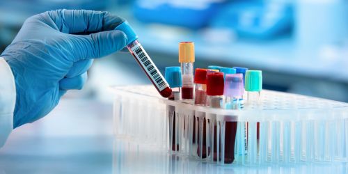 Esami del sangue per pazienti "fantasma", 24 indagati nel Cosentino