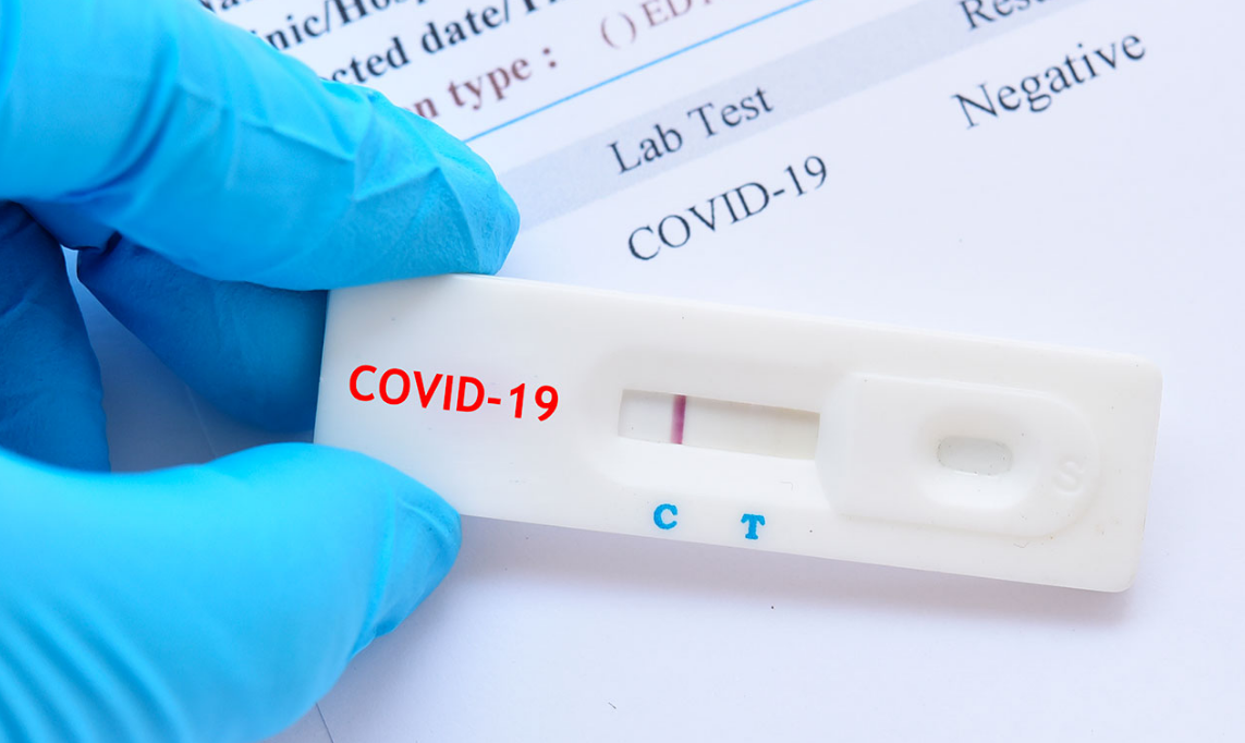 Covid, stabili i casi di contagio in Calabria: +1.226 nelle ultime 24 ore