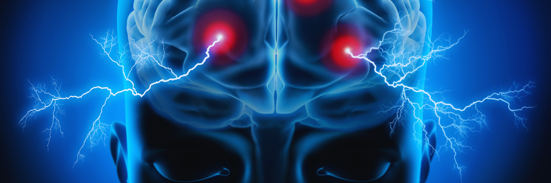Emicrania con aura: svelato il mistero in uno studio rivoluzionario