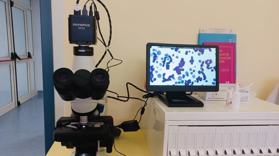 Al GOM di Reggio Calabria operativo il nuovo microscopio di alta generazione