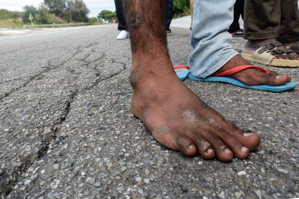 I migranti dimenticati ad Amendolara