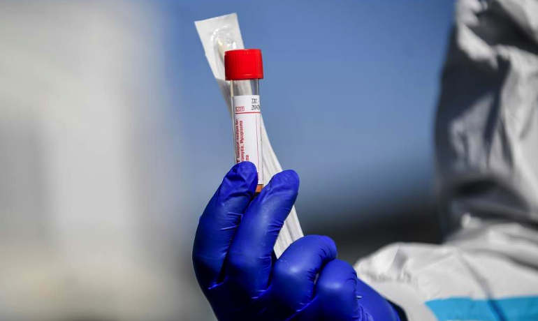 Covid, in Calabria tasso di positività al 5,41% e 49 casi. Nessun decesso