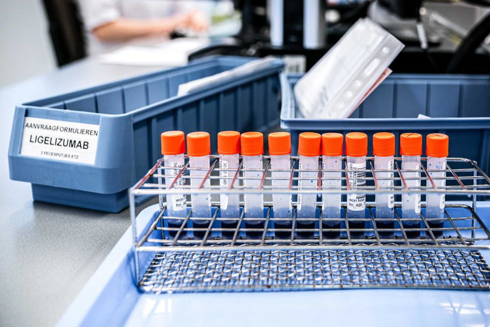 Coronavirus, a Cosenza arrivano le scorte del farmaco anti artrite