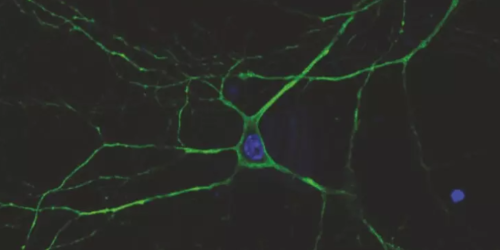 Arriva dalle lucciole un nuovo trattamento per l’epilessia