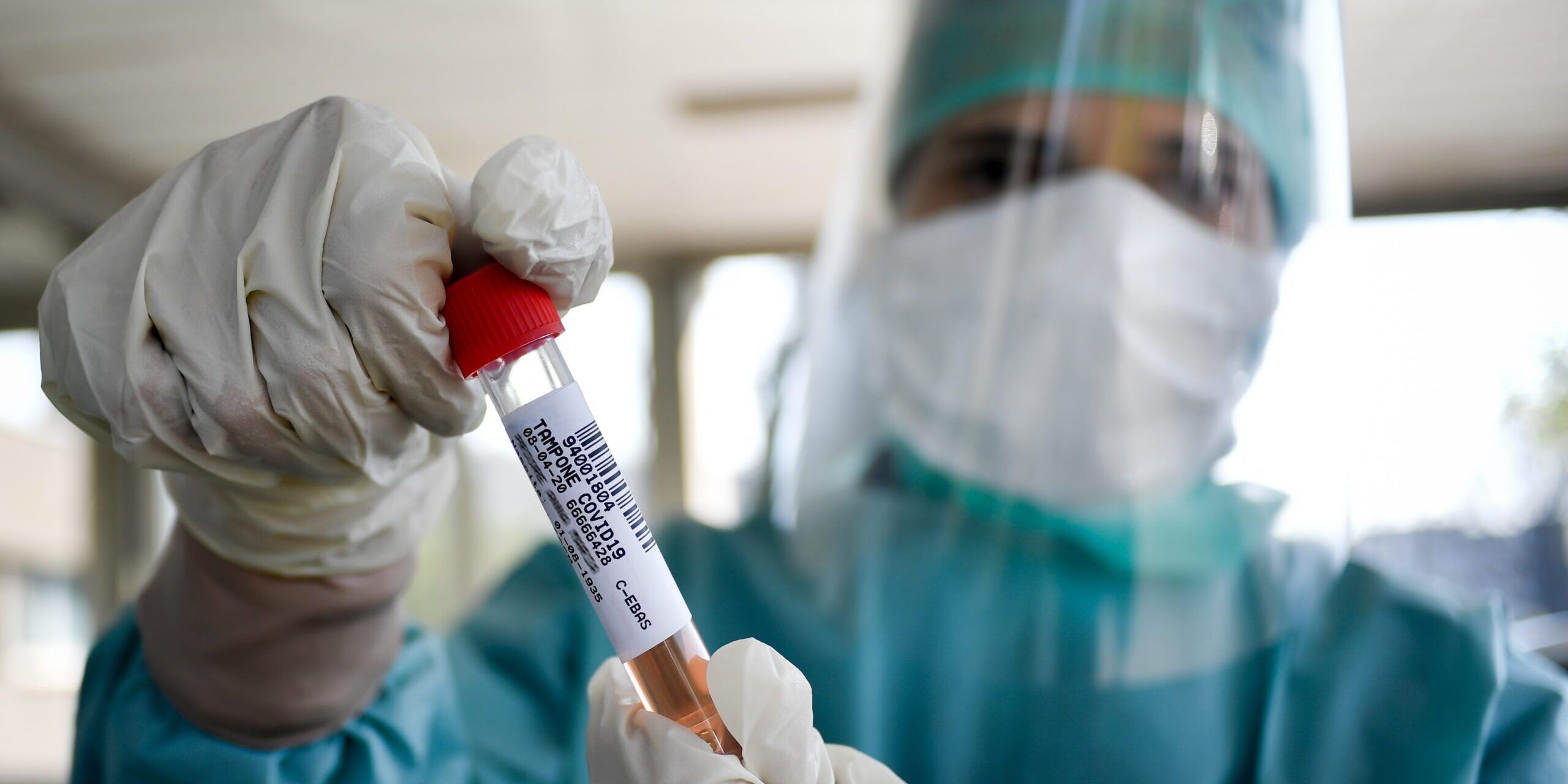 Coronavirus, 318 nuovi contagi e sette morti