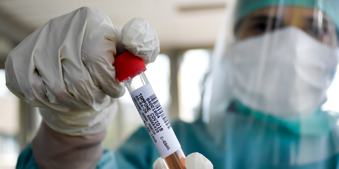 Covid, monitoraggio ridotto: nelle ultime 24 ore 933 casi su 4.961 tamponi – GRAFICO