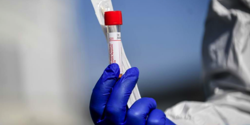 covid coronavirus tamponi