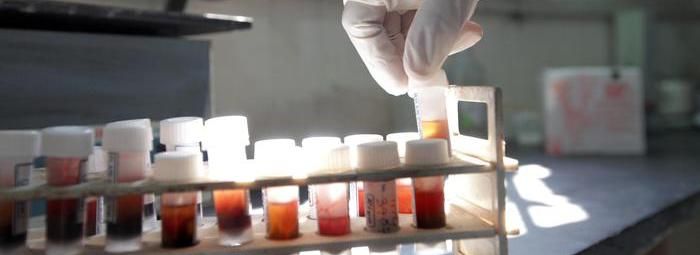 Trasmise l’Aids alla compagna che morì, condannato a 22 anni