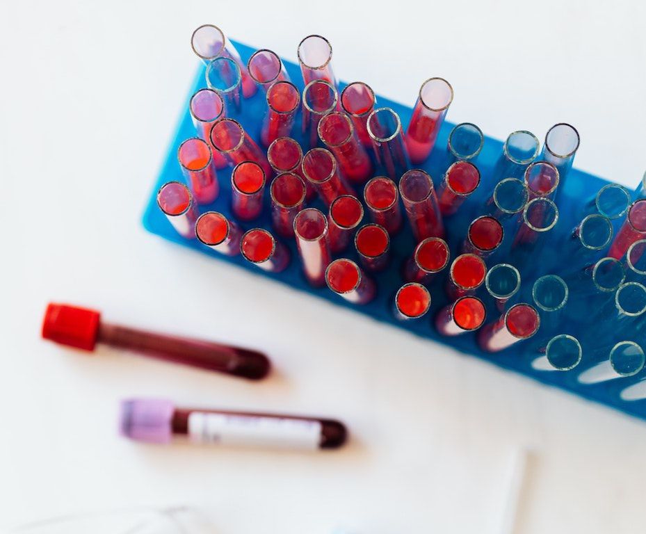 A Crotone continua la “guerra” per la macchina dei tamponi. Che resta ferma