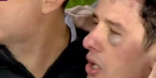 arbitro turco aggredito