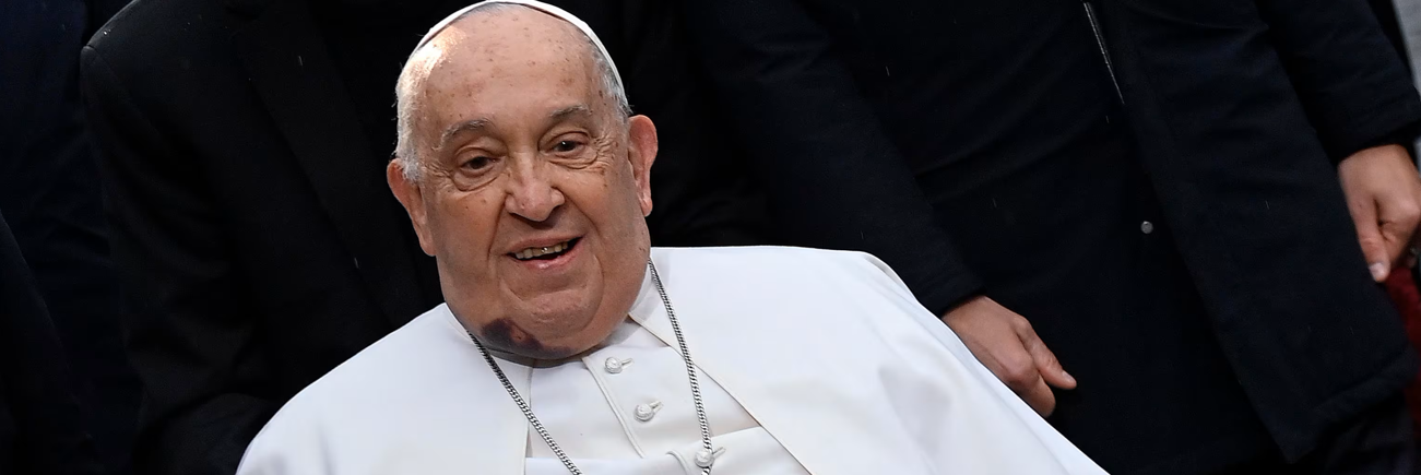 Papa, la prognosi resta riservata. «Lieve insufficienza renale»