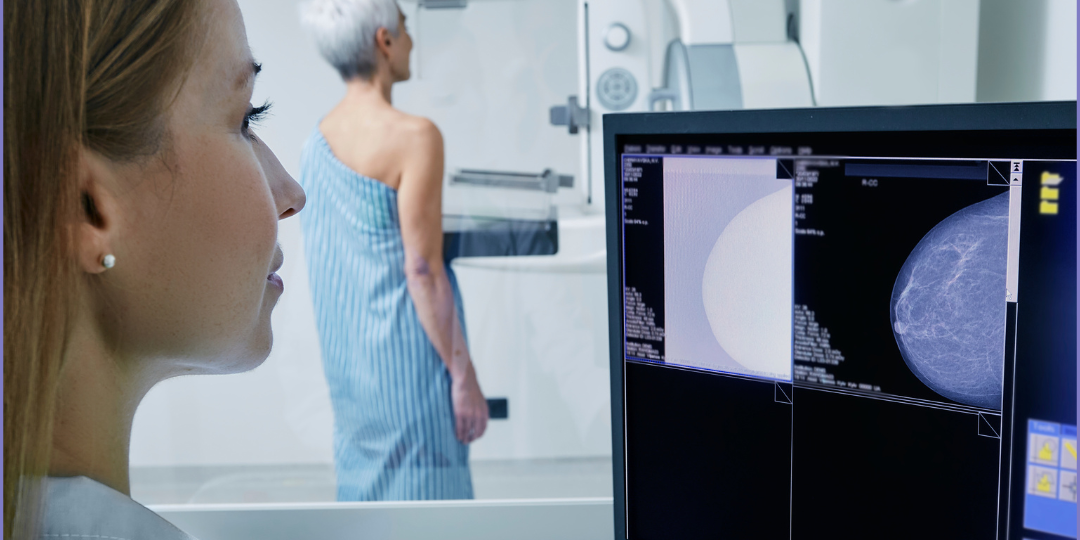 Tumori del seno, nuove frontiere per i test genetici 