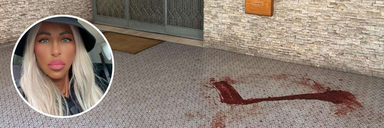 Massacra a colpi di mazza la compagna, arrestato 56enne a Bologna