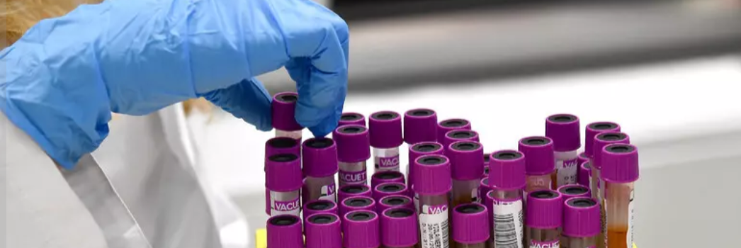 Sla, un prelievo di sangue può diagnosticarla